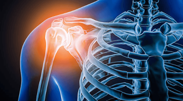 Robotic Shoulder Replacement
