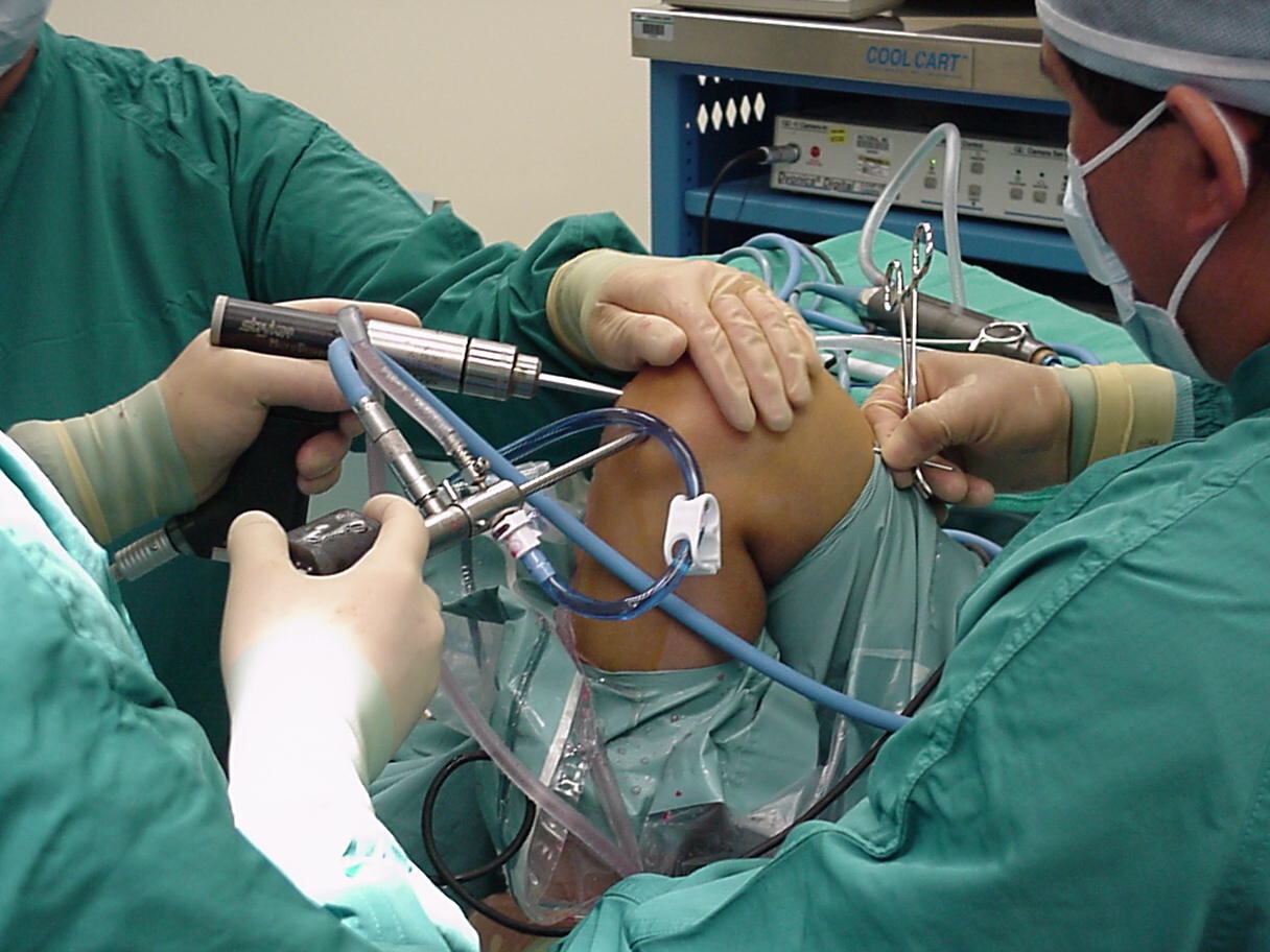 ACL & PCL Meniscus Injuries - Main Information