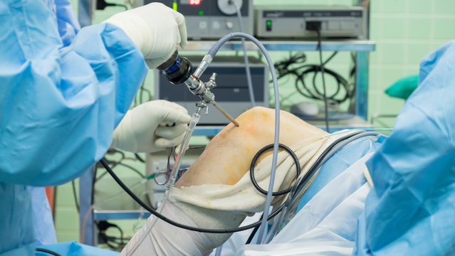 ACL & PCL Meniscus Injuries - Why Choose Us