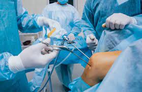 Knee Arthroscopy - Main Information