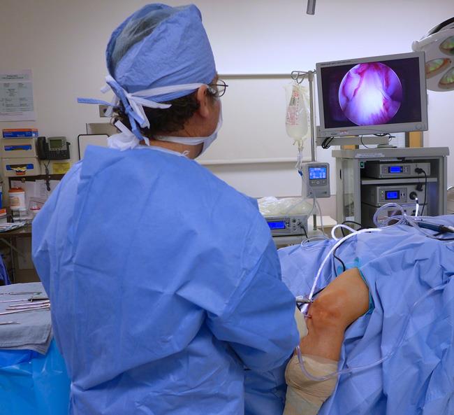 Knee Arthroscopy - Services and Benefits