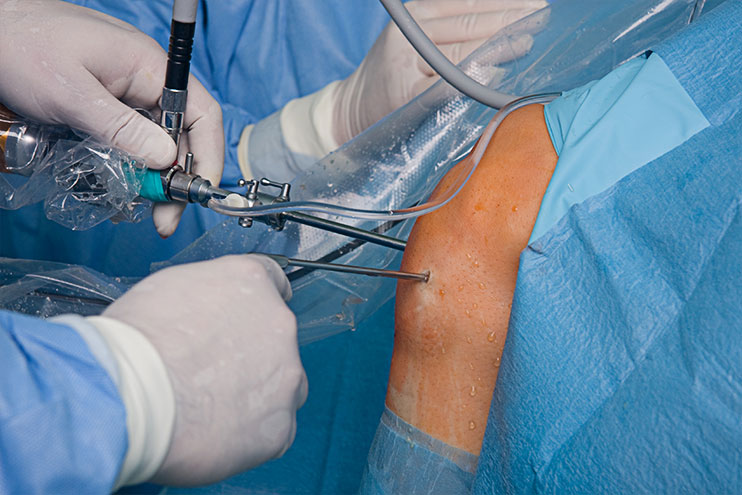 Knee Arthroscopy - Why Choose Us