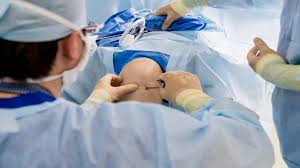 Knee Arthroscopy