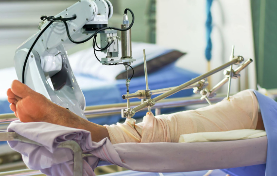  Knee treatment of ACL, PCL and meniscus injury by best orthopedic specialist Dr. Ankur Singh.