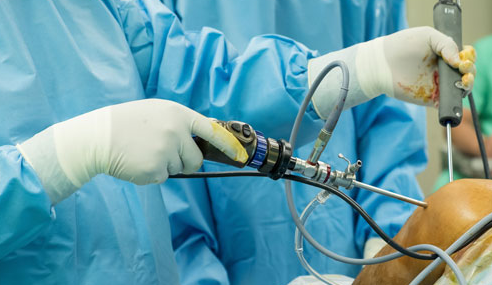 Knee arthroscopy surgery diagnosis by best orthopedic in Noida, Dr. Ankur Singh