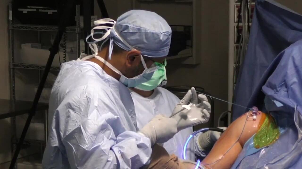 Shoulder Arthroscopy - Services and Benefits