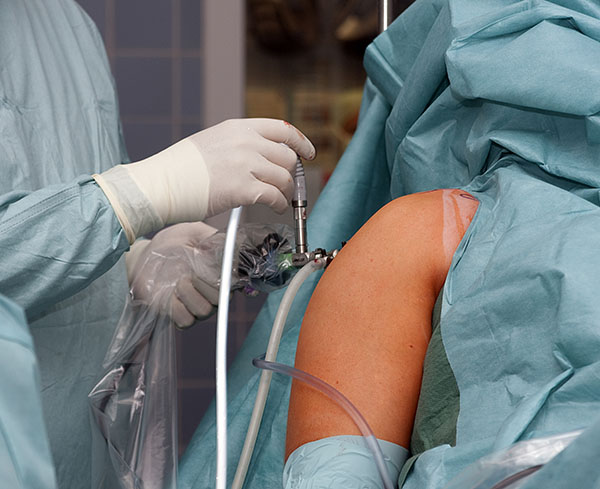 Shoulder Arthroscopy - Why Choose Us